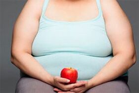 Για να θεραπεύσετε τους κιρσούς, πρέπει να χάσετε το περιττό βάρος